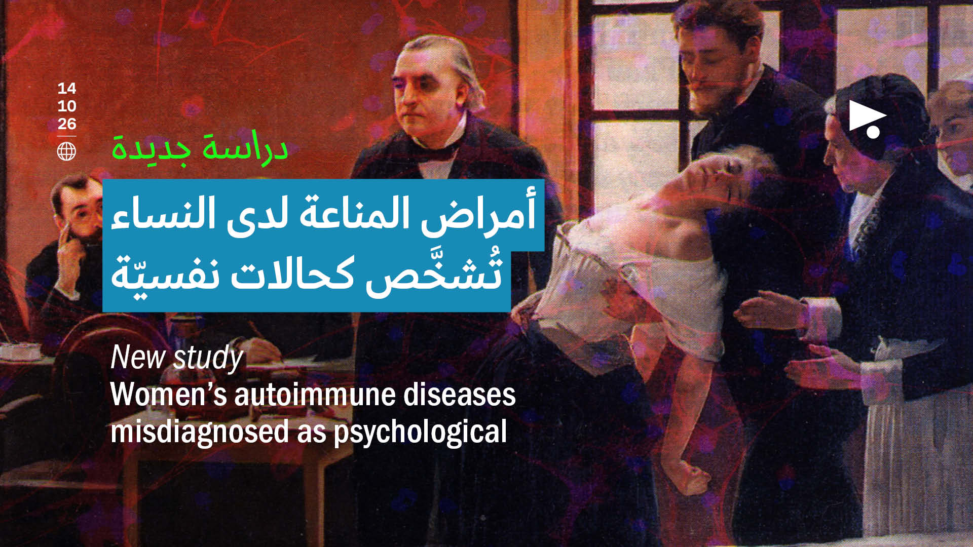 دراسة جديدة: أمراض المناعة لدى النساء تُشخَّص كحالات نفسيّة