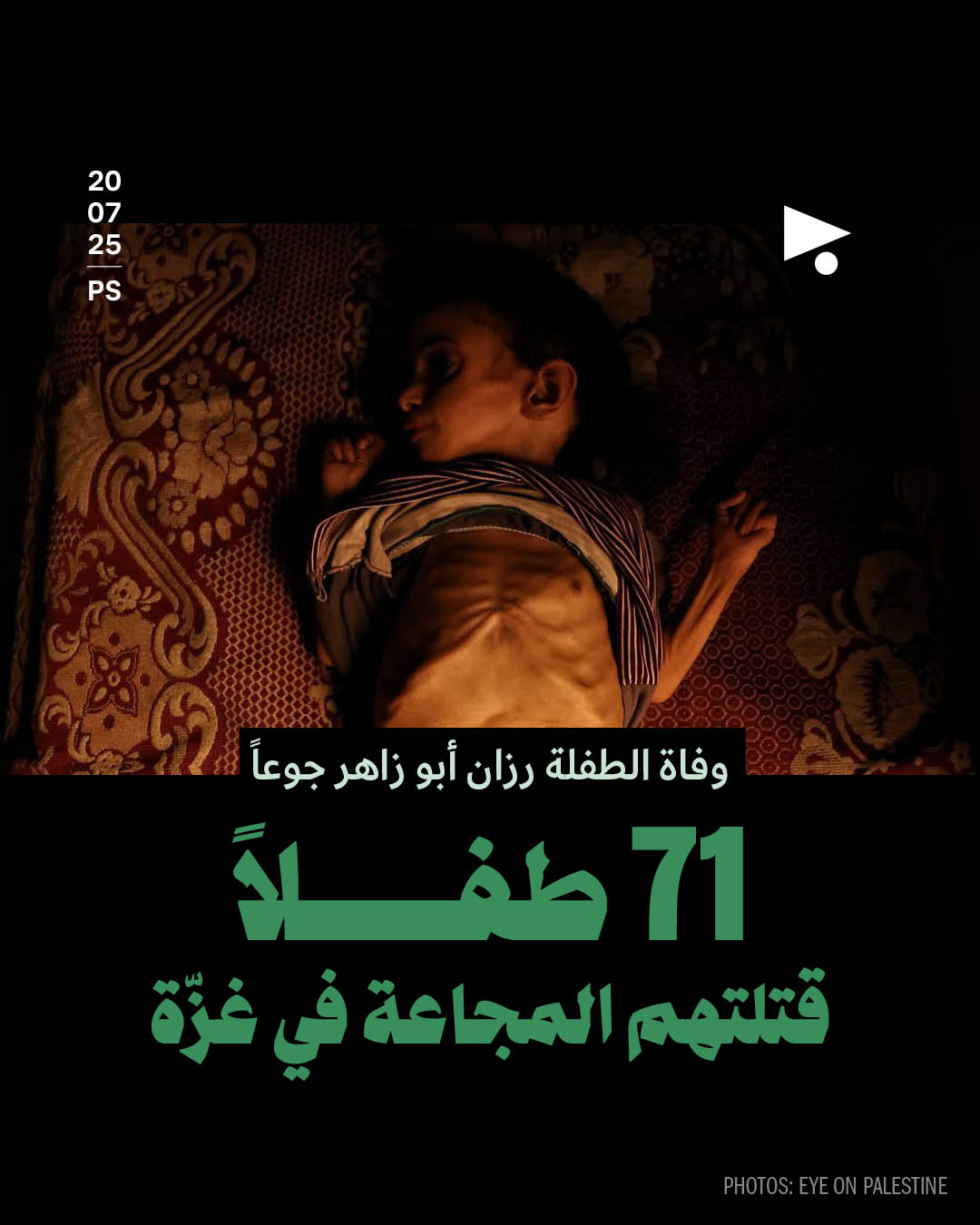 وفاة الطفلة رزان أبو زاهر جوعاً 71 طفلاً قتلتهم المجاعة في غزّة