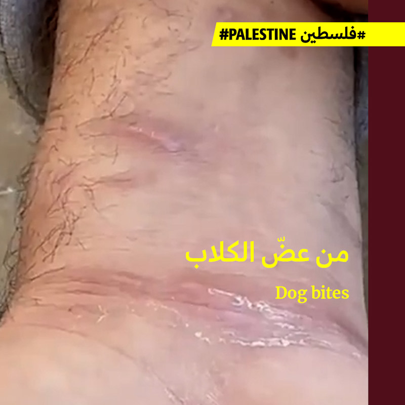 شهادة معتقل من داخل غزّة